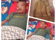 “”PERUT DANANG HARUS DITUTUPI PLASTIK,, AGAR BAGIAN DALAMNYA TETAP STERIL DAN TIDAK TERBUKA, SERTA KELIHATAN..,,””